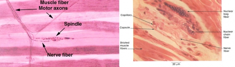 Файл:Spindle photo.jpg